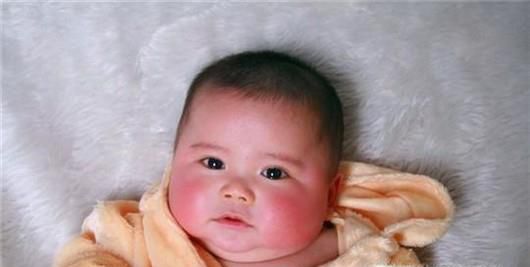 宝宝冬日如何不得冻疮？宝宝得了冻疮怎么办？