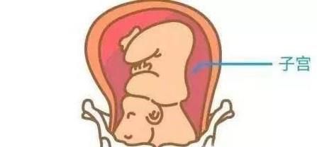 讲解胎儿不入盆的原因