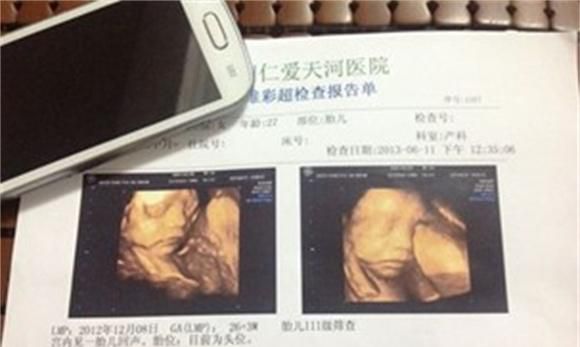 打四维宝宝的图片和生下宝宝的相貌有区别吗 快来看看