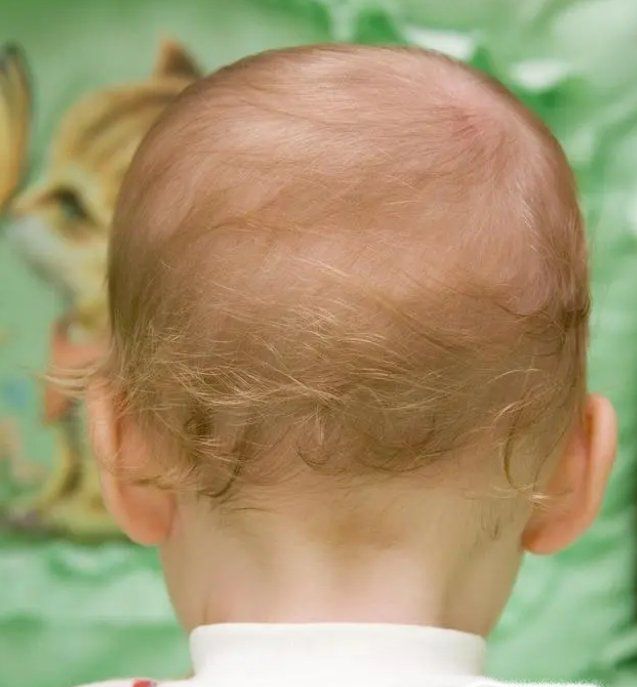 宝宝怎样睡头型好看？