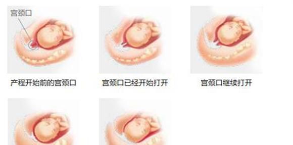 生完孩子以后  肚子里还会有一个宝宝在动吗 别惹出笑话了