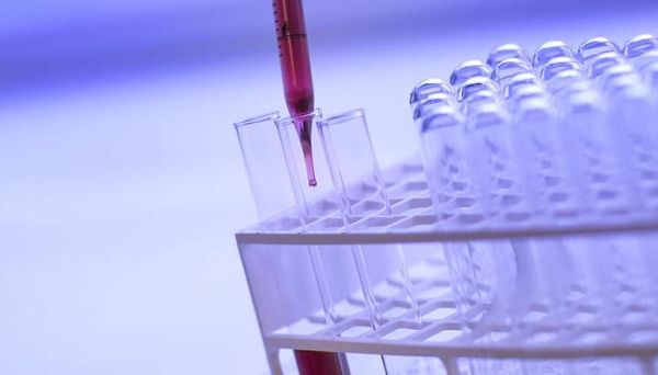 铝单质与氢氧化钠溶液反应的方程式 铝单质与氢氧化钠溶液反应的方程式是什么