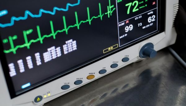 振动图像和波动图像的区别 振动图像和波动图像的区别是什么