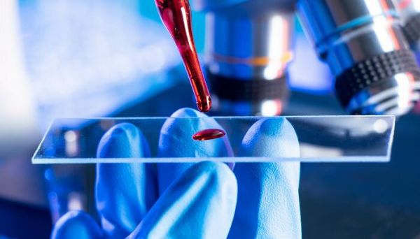 苯酚与甲醛的缩聚反应 苯酚与甲醛的缩聚反应怎么写