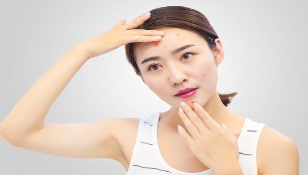 红血丝肌肤护肤要注意什么 怎样修复红血丝皮肤