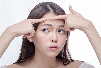 额头长痘是什么原因 额头长痘怎么回事