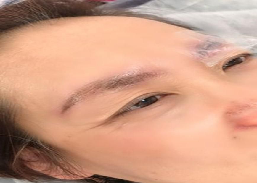皮肤敏感可以纹眉吗