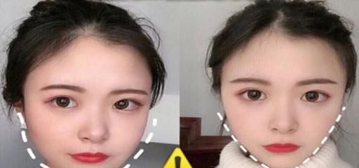 怎么瘦脸颊两侧肉肉