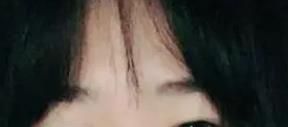 亲身经历割双眼皮手术的恢复过程