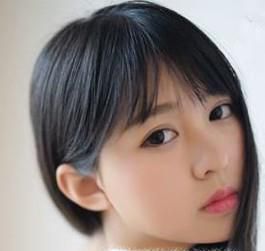 五大方法解决发际线后移