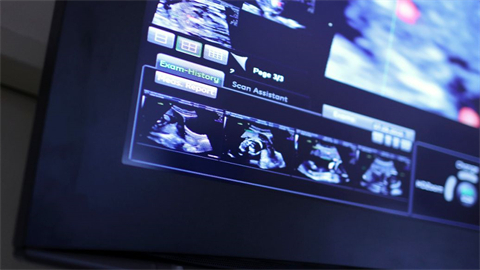 编辑视频的软件哪个比较好用 强大的视频编辑软件推荐