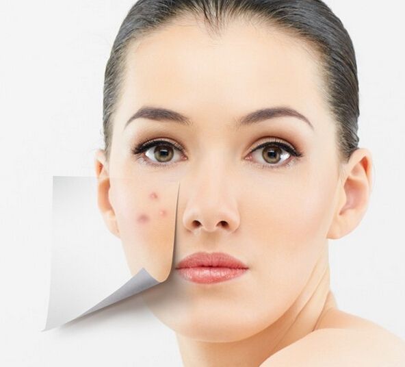 美图秀秀怎么去除痘痘疤痕？美图秀秀去除痘痘疤痕图文教程