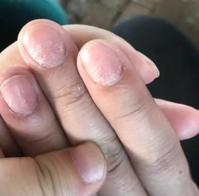 指甲油的危害
