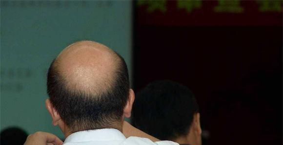 中年油腻男的判断标准