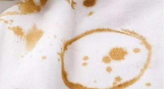 衣服上的茶渍怎么去除
