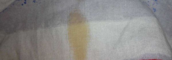 衣服上油点用洗洁精可以去除吗?
