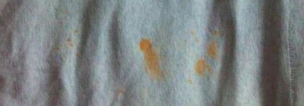 白衣服上的铁锈怎么去除小窍门