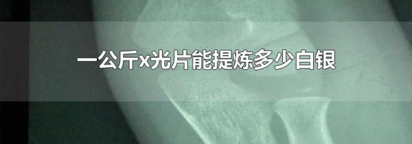 一公斤x光片能提炼多少白银