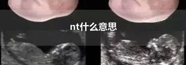 nt什么意思