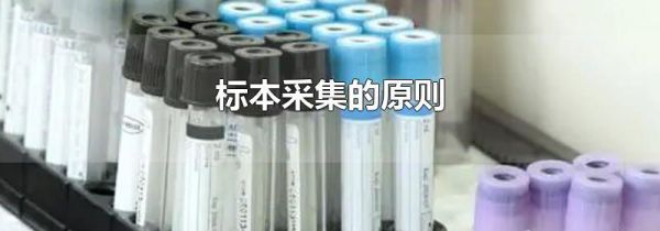标本采集的原则