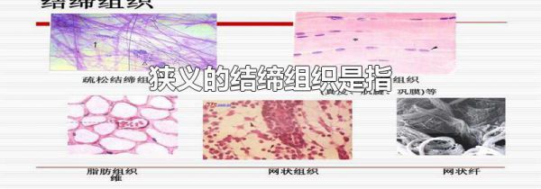 狭义的结缔组织是指