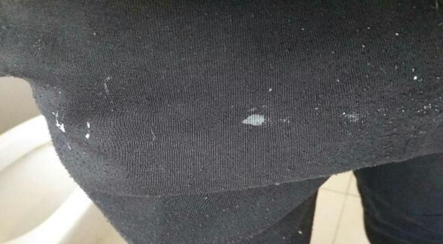 黑裤子上的白胶怎么样才能洗掉