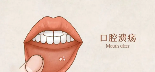 孕妇可以用意可贴吗