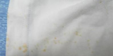 怎样快速去除衣服上的铁锈
