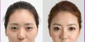 圆脸瘦成瓜子脸的方法