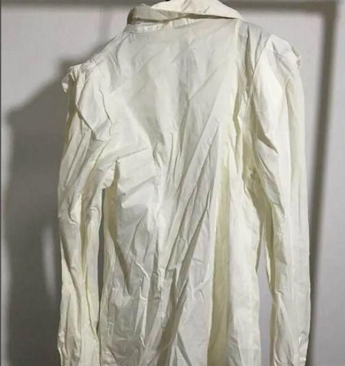 衣服烧黄了该怎么处理