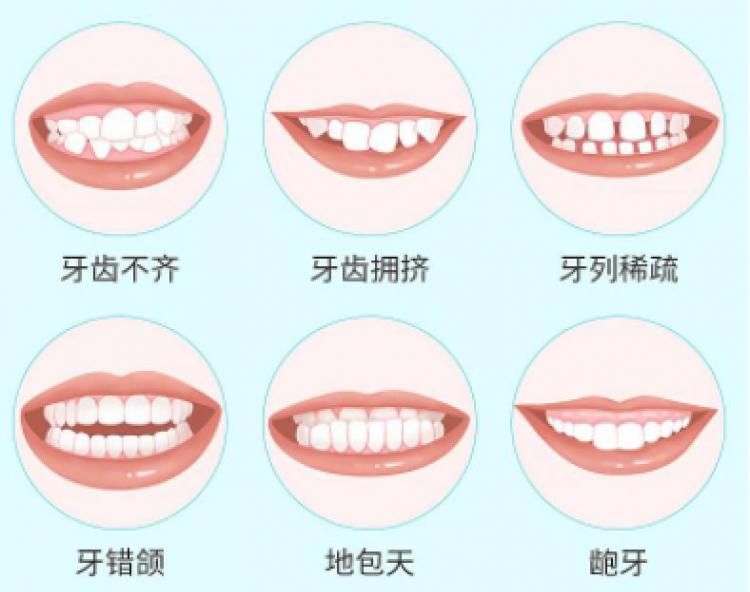 牙齿正畸需要注意什么内容？