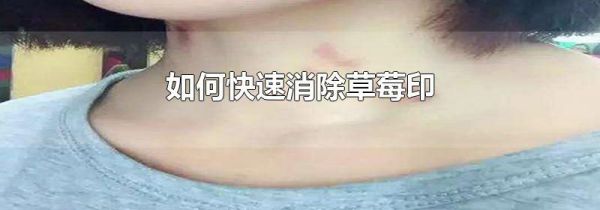 如何快速消除草莓印