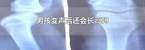 男孩变声后还会长高吗