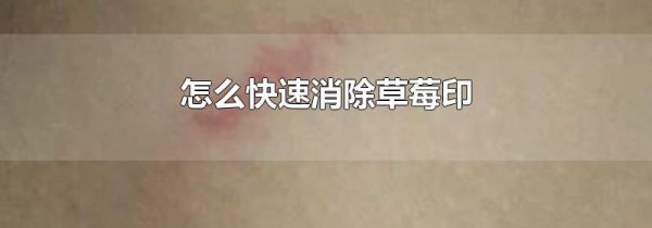 怎么快速消除草莓印