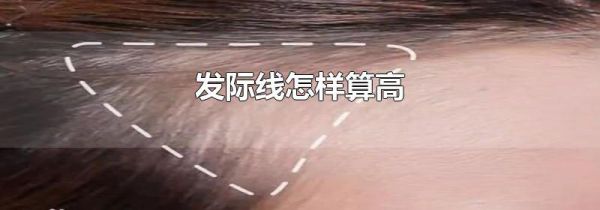 发际线怎样算高