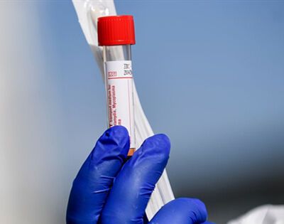 北京生物新冠疫苗是国药还是科兴？