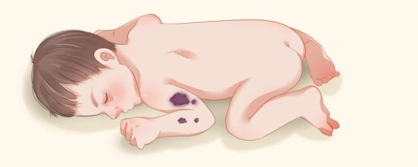 小孩得了甲型流感呕吐怎么办 肚子痛怎么回事