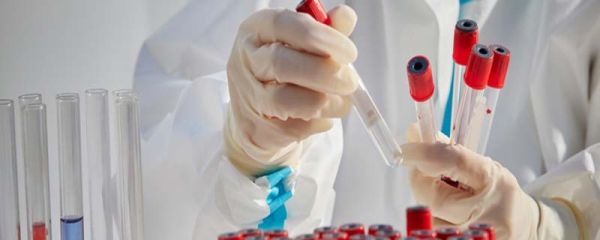 甲醛超标怎么检测 甲醛超标检测方法是什么