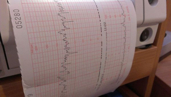 声呐是超声波还是次声波  声呐是超声波吗