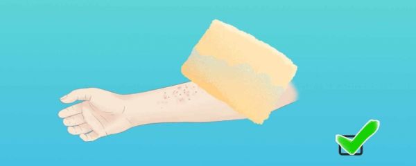 宝宝是过敏体质需要注意什么 有哪些特征